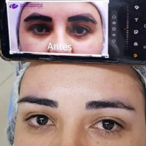 tratamento-esteticos-1-500x500.jpeg (1)